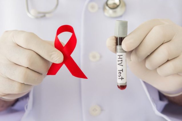 Тестирование на ВИЧ будет проходить с 25 по 28 июня 2018г